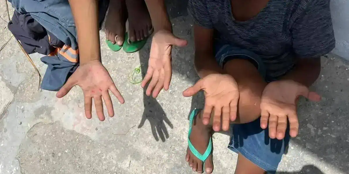 Meninos mostrando mãos sujas e machucadas, representando vulnerabilidade e necessidade de atenção social.