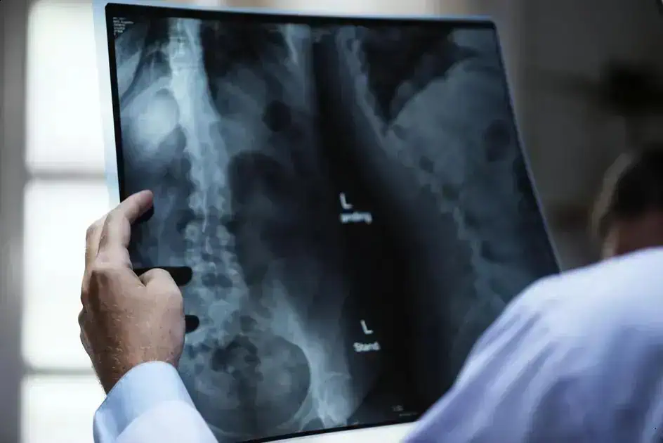 Cooperativa condenada a indenizar trabalhador por doença ocupacional