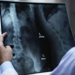Cooperativa condenada a indenizar trabalhador por doença ocupacional