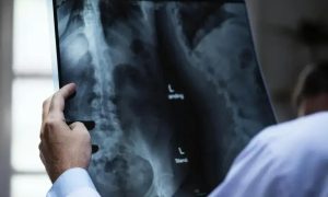 Cooperativa condenada a indenizar trabalhador por doença ocupacional