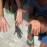Meninos mostrando mãos sujas e machucadas, representando vulnerabilidade e necessidade de atenção social.