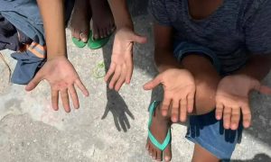 Meninos mostrando mãos sujas e machucadas, representando vulnerabilidade e necessidade de atenção social.